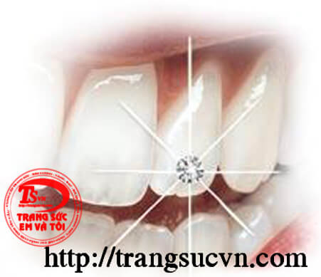 Kim cương thiên nhiên gắn răng, gắn răng kim cuong